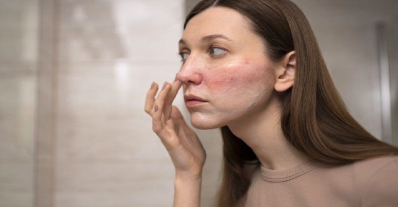 মুখের যে লক্ষণে বুঝবেন বেড়েছে কোলেস্টেরল