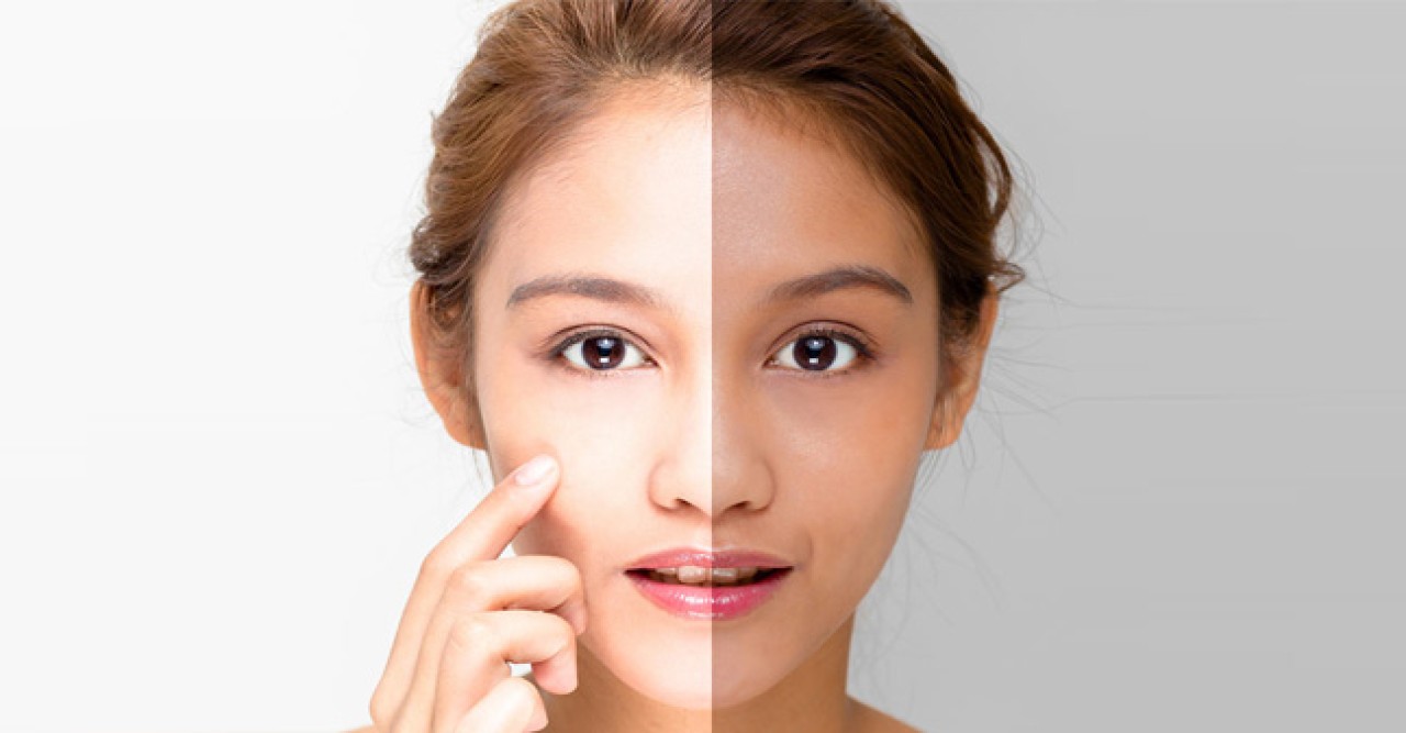 এই শীতে ৪ জাদুকরী উপাদানে যত্নে থাকবে ত্বক