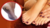 পা ফাটা দূর করার ঘরোয়া উপায়
